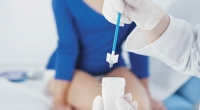 Citología líquida: ventajas en la detección temprana del cáncer cervical