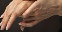 Artritis Temprana: ¿cómo detener el daño articular?